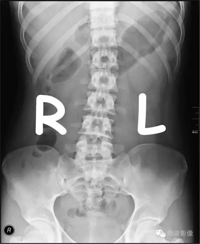 X线高清图谱|精致腹部解剖