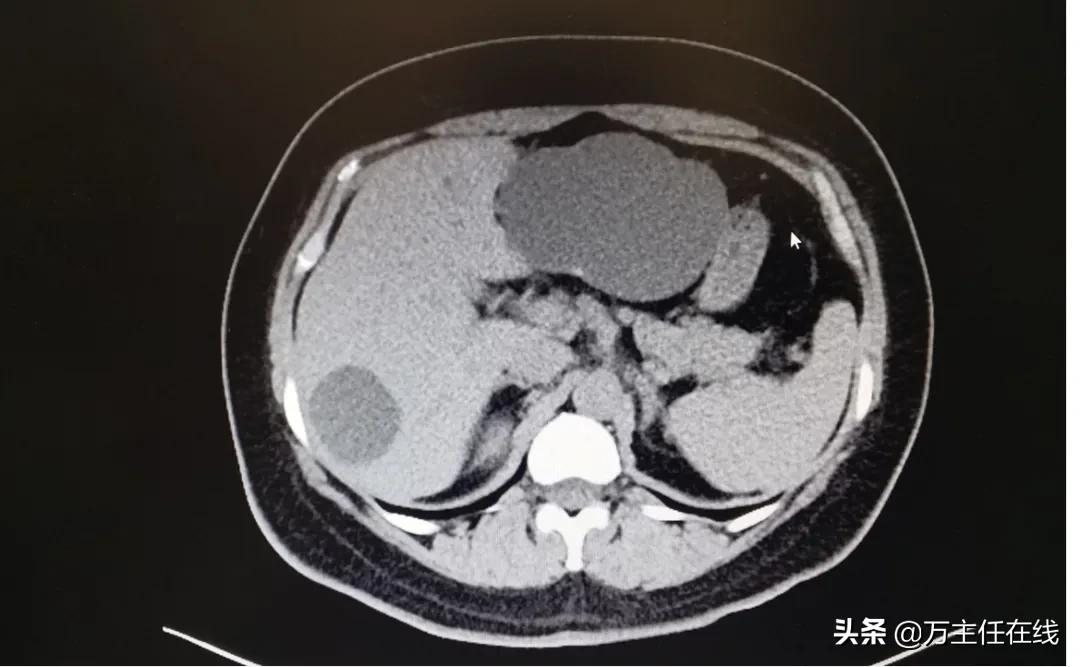 镜益求精！上海市第一人民医院万荣团队为患者带来“无痕”的美丽