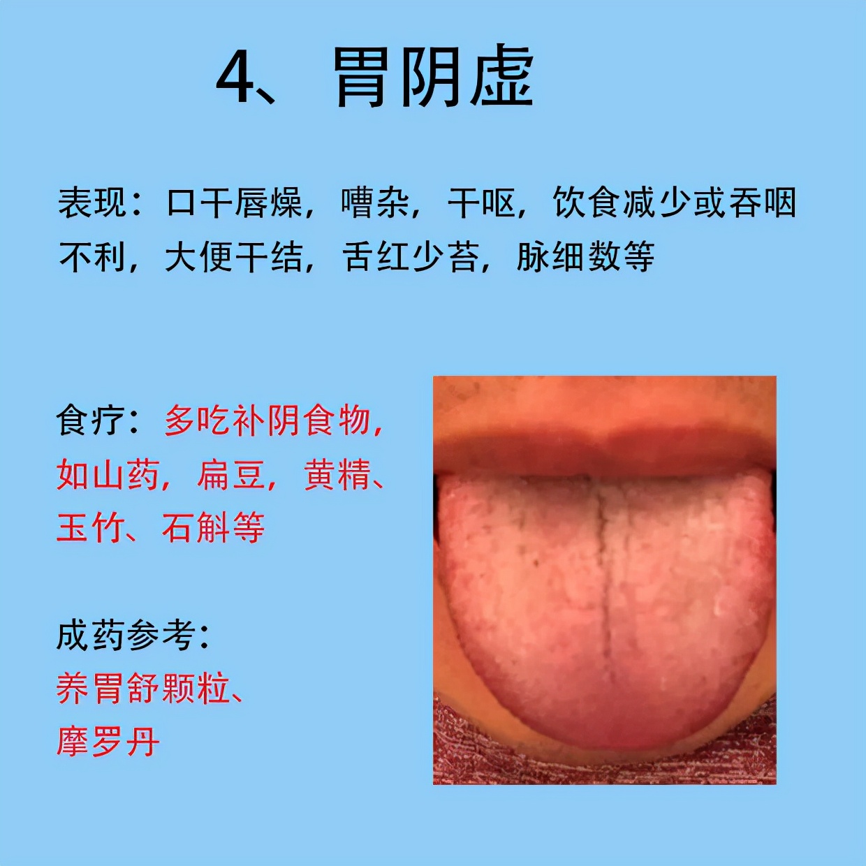 路志正调理脾胃12法特别厉害,脾胃虚弱路志正