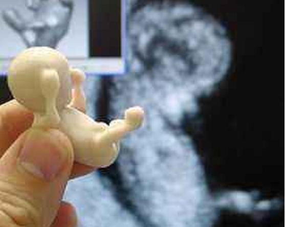 人工流产的胎儿最后去哪了,人工流产胎儿去哪了