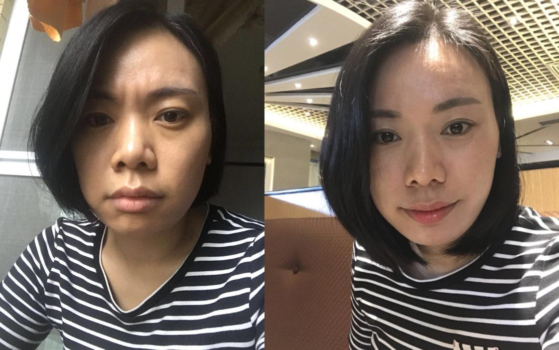 抗衰不再是简单的面部抗衰,抗衰老增加颜值