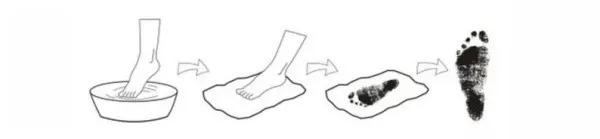 小孩子鞋被电梯卡,小朋友脚被卡到电梯里