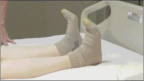 怀孕产妇应该注意什么事项,一般产后多久会出现肺栓塞