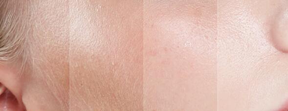 美妆巨头抢占美白市场澳洲RMD推出“黄金比例”烟酰胺精华液