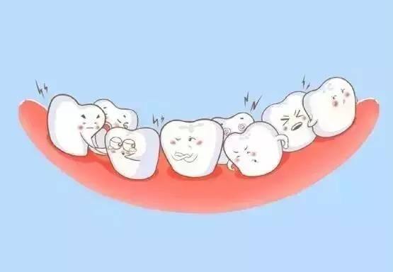 补牙后的注意事项你知道哪些,洗牙补牙后注意事项