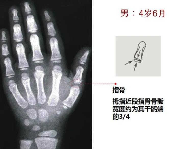 孩子个子高却跑不快,孩子个头不高怎么办