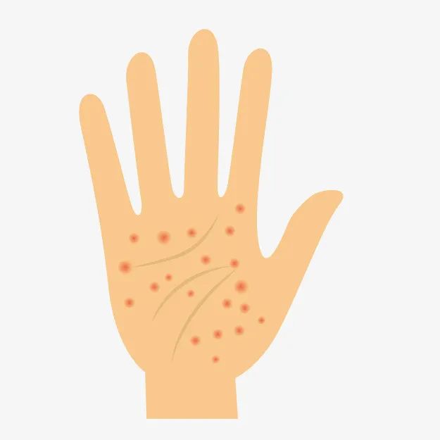 女人美甲到底该不该做,美甲指甲表面开裂是怎么回事