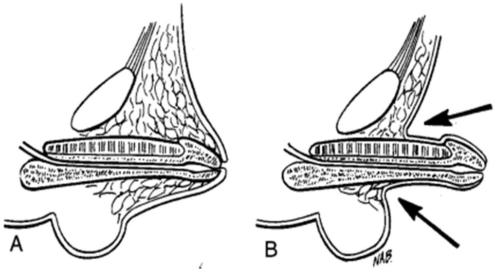 为什么丁丁总是回缩？