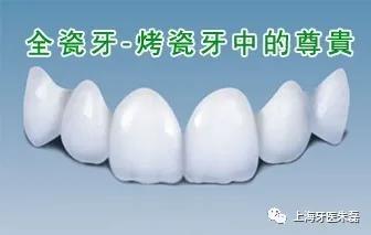 牙齿美容全瓷牙的优缺点有哪些,牙齿美容烤瓷牙费用