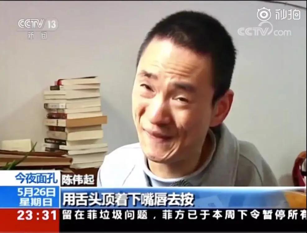 轻度脑瘫不治疗会瘫痪吗,放弃治疗是不孝吗