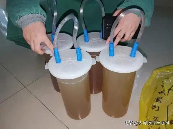 25岁女孩肚子巨型肿瘤,肚子里特大肿瘤的25岁女孩