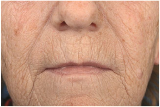 抗衰老抗氧化抗糖化非常好用,护肤品抗氧化和抗糖化是什么意思