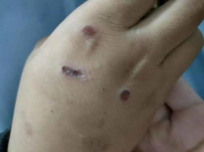 7岁男孩被继母灌消毒液,七岁男童遭继母虐待成植物人