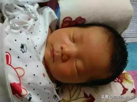 粟粒疹宝宝,宝宝红斑丘疹鉴别图谱