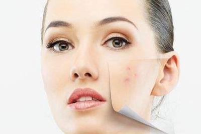 怎么祛痘印最快最有效的方法,如何快速祛痘印最有效的方法