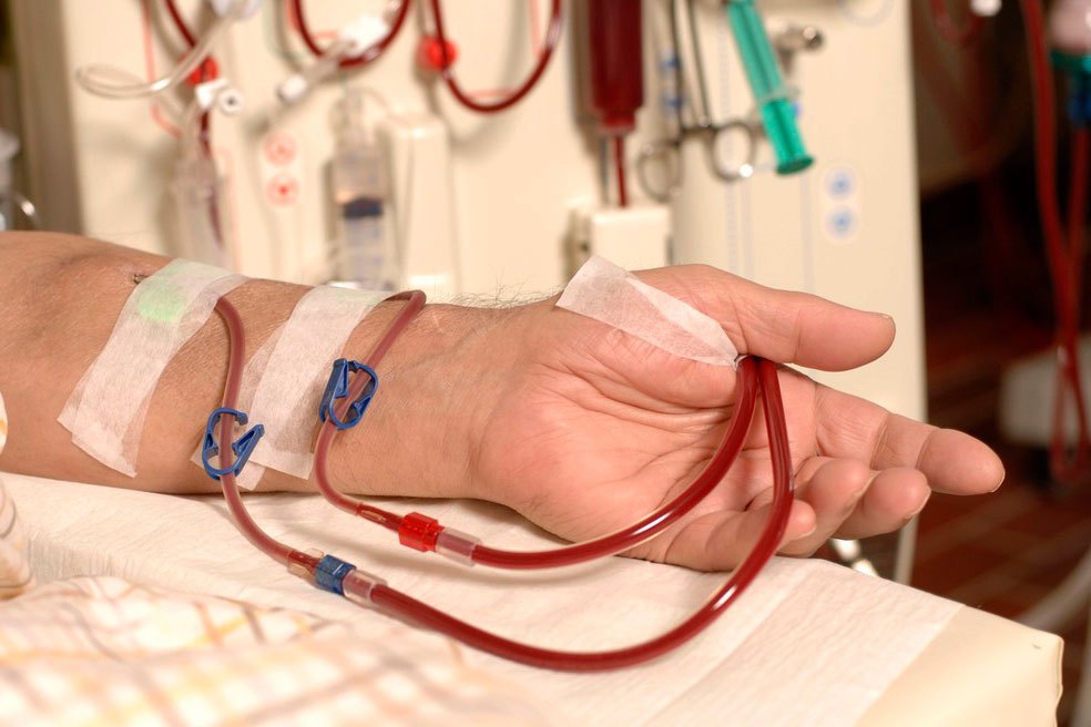 喝水越多越伤肾怎么喝水最健康,喝水越多对肾脏的损害就越大