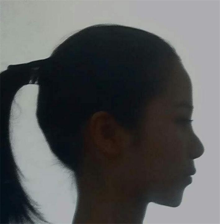 5岁后脑勺平怎么补救,女孩后脑勺平