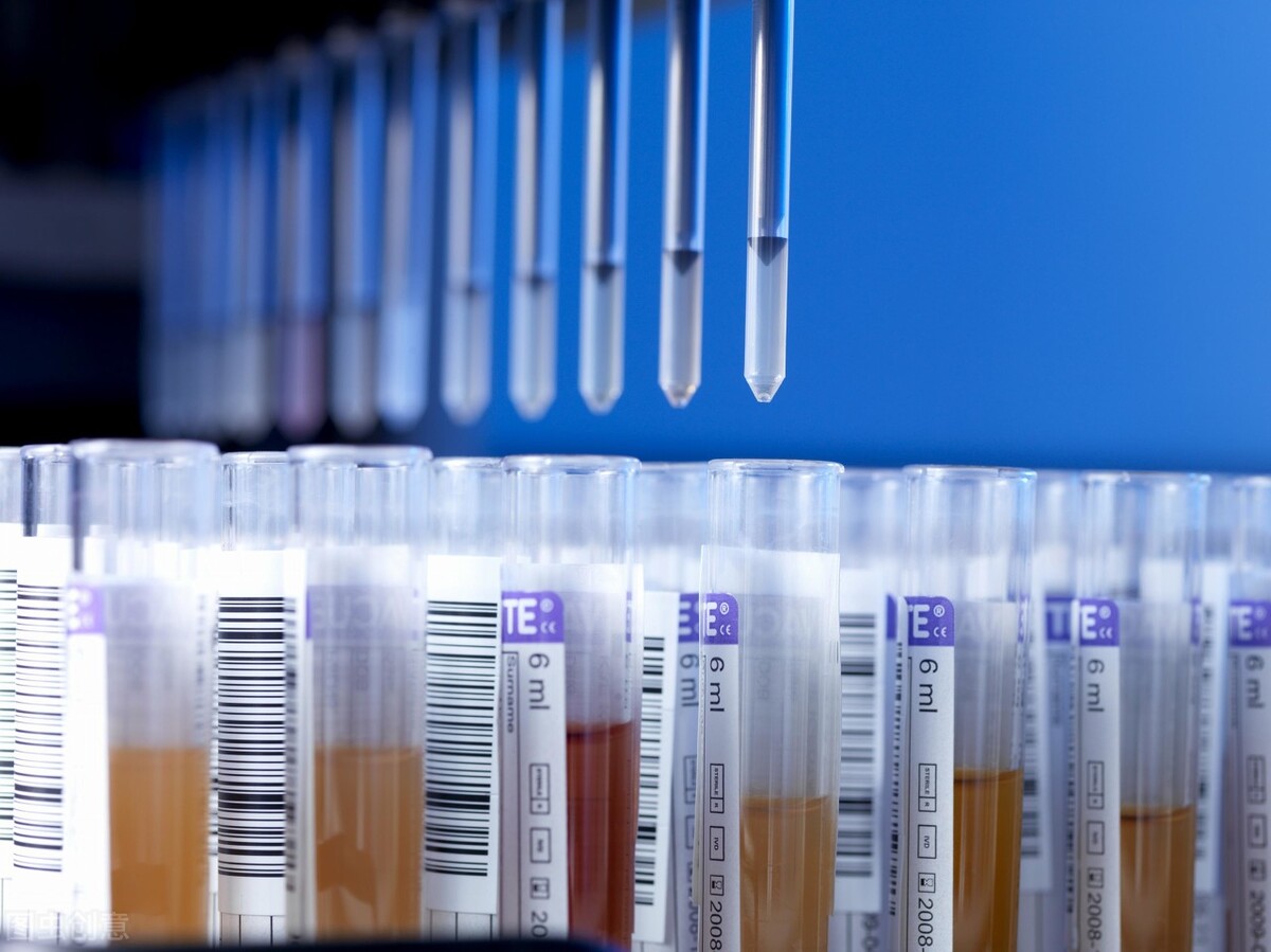 怎么降低低密度脂蛋白ldl-c,小而密的低密度脂蛋白怎么检测