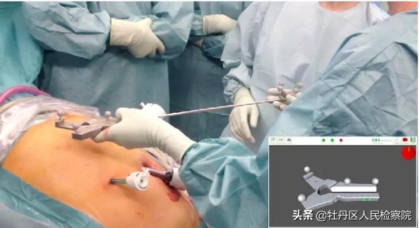 赵英俊肝癌做手术了吗,赵英俊肝癌做了手术没有