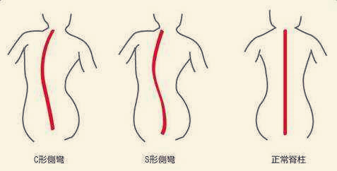 胸肌不对称用哑铃怎么卧推,一对哑铃胸肌怎么练变饱满变厚