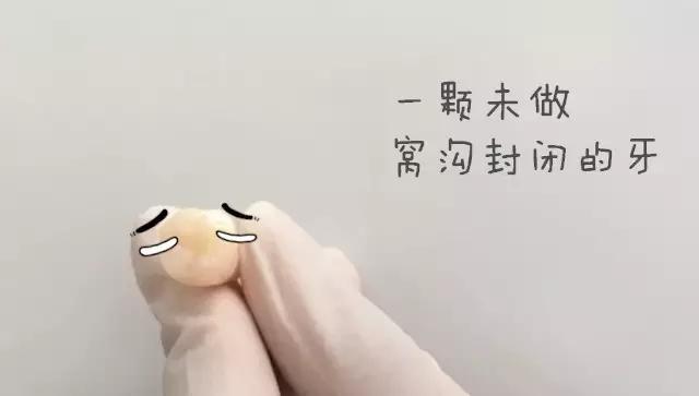 什么是儿童窝沟封闭?会不会痛?1分钟视频带你看懂#雅悦齿科#