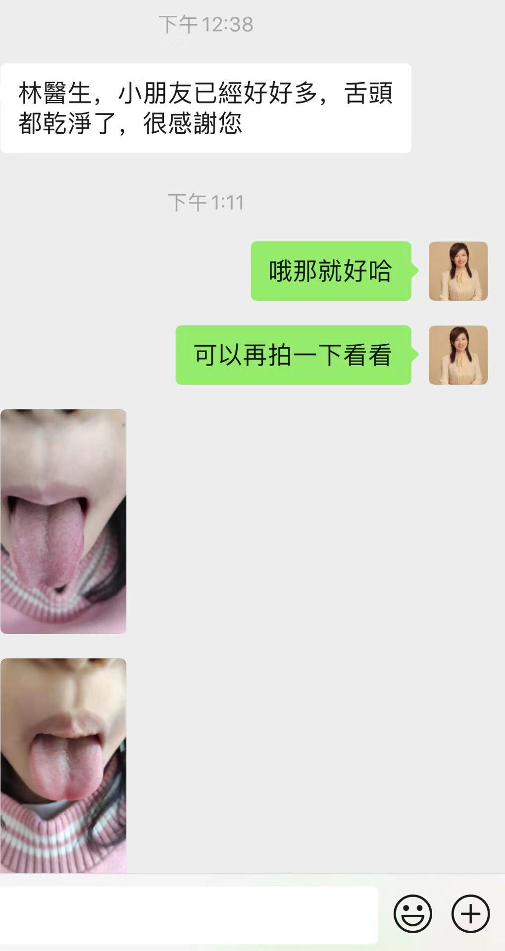 小儿积食发热中医解决方法,积食发热的中医治疗