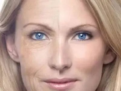 妊娠纹皱纹去除最好的办法,抗皱的护肤品可以祛妊娠纹吗