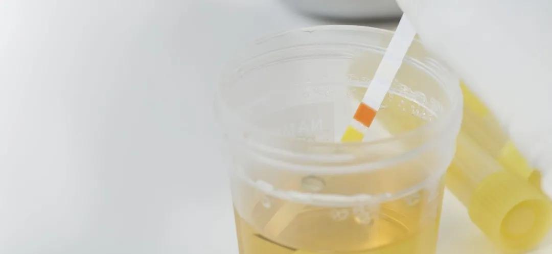 高血粘症是怎么造成的,高粘滞血症预后怎样