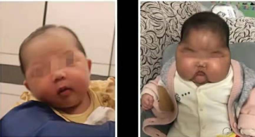 用婴儿面霜额头会长毛吗,婴儿六个月额头上长汗毛