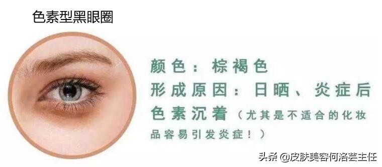 熬夜怎么快速去除黑眼圈,熬夜怎么消除黑眼圈学生党