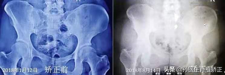 脊骨神经医学（美式脊椎矫正）精品课程