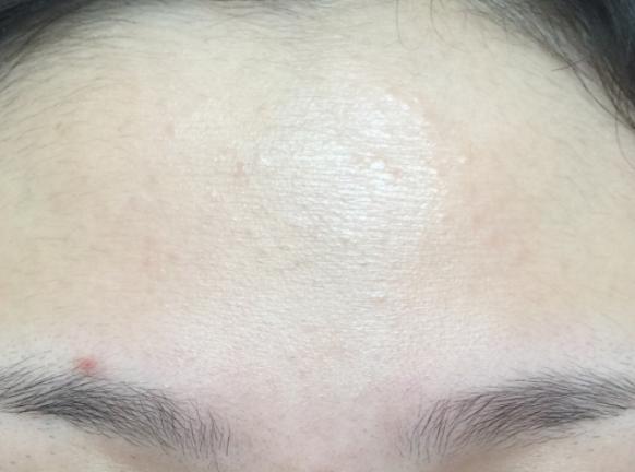 最省钱的去闭口方法,平价去闭口最有效的方法