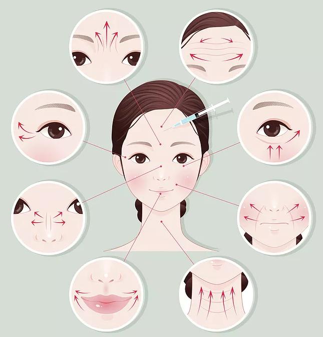 瘦脸针讲解视频,瘦脸针的原理与作用安全有效