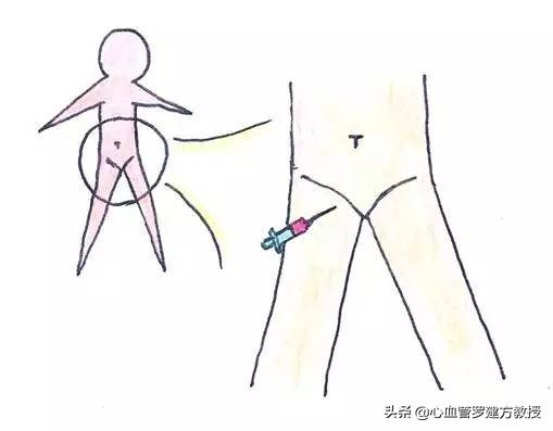 发生心律不齐，怎么样才能恢复正常？#原创首发##青云计划#