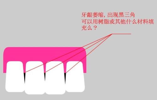 黑三角到底是什么,为什么黑三角越来越多