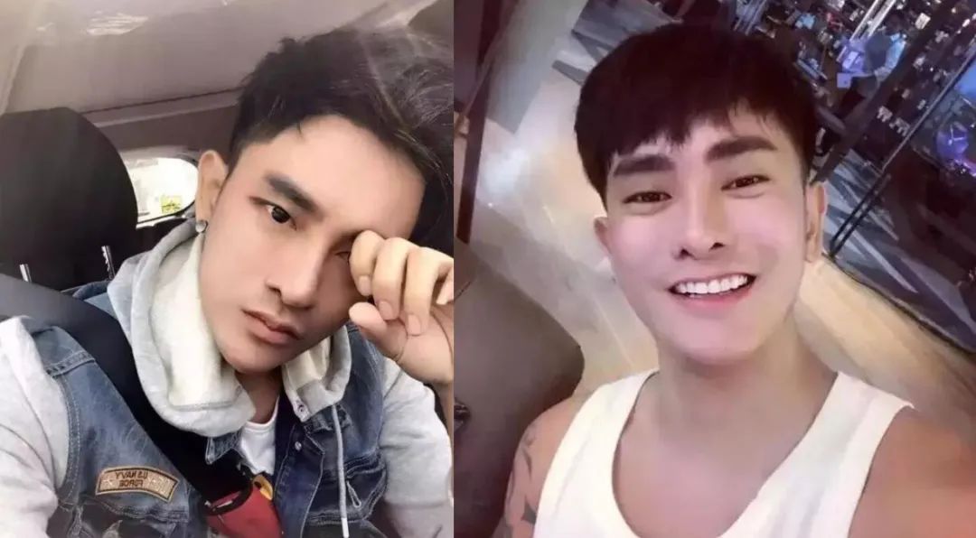 男子整容后从此走上人生巅峰,24岁小伙整容失败变大叔