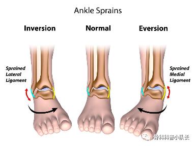 崴脚超过24小时是热敷还是冷敷,崴脚超过48小时是热敷还是冷敷