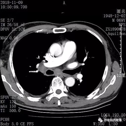怎么应用统计学做调查,统计学方法可以解决的主要问题