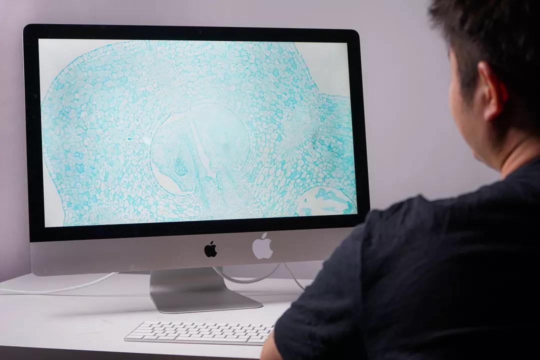 华为手机显微镜放大1000倍清晰,怎样才能把手机变成显微镜模式