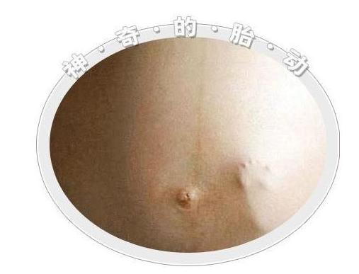 胎动异常紧急处理,胎动为什么有时候感觉到痛