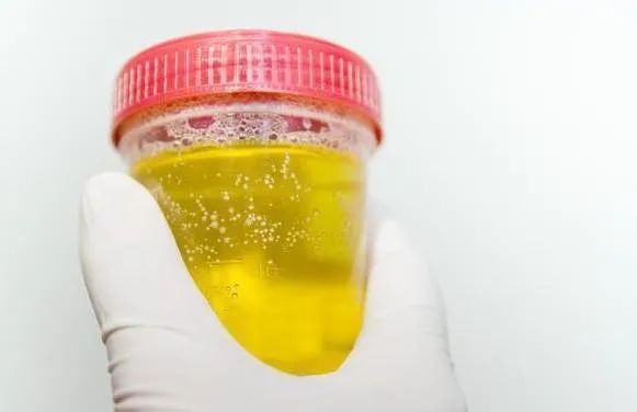 糖尿病人应该多喝水还是少喝水,糖尿病人喝水多好还是喝水少好呢