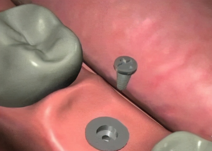 上海雅悦齿科种植牙价格,雅悦齿科医院简介