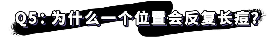 纯干货祛痘指南!低成本、见效快