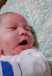 得湿疹了自己会好吗,得了湿疹要忌什么