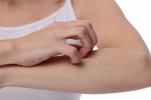 过敏体质的人很困扰？如何摆脱？或可从这四个方面来进行调理