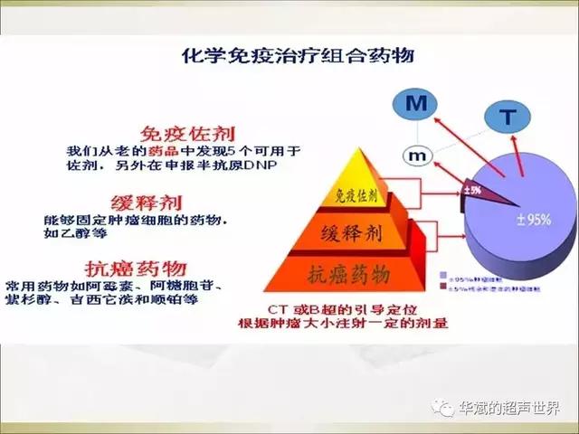 超声介入化疗,超声引导下穿刺注射药物