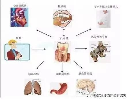 比较严重的牙周炎,时不时会流牙血应该如何治疗？