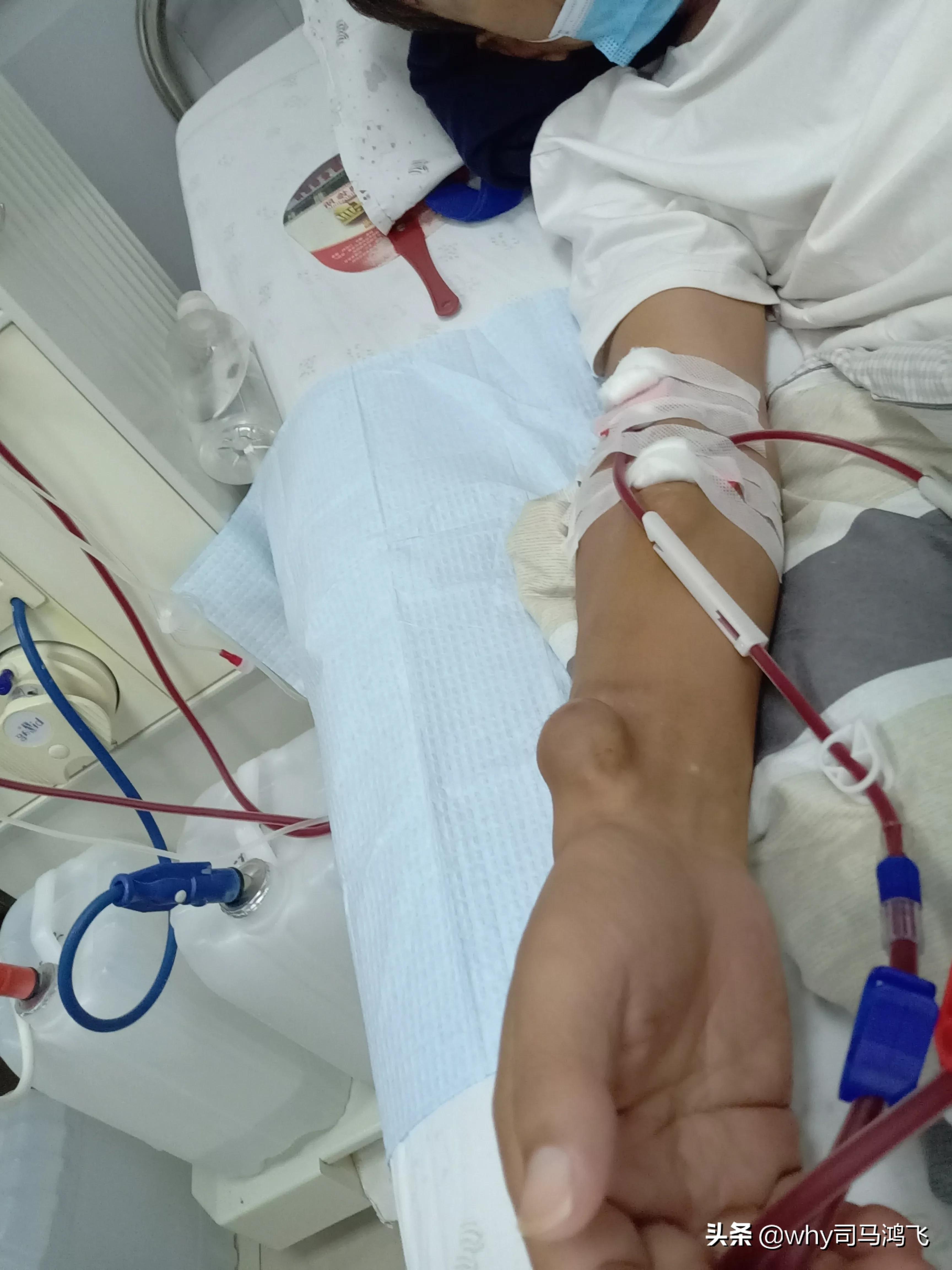 一个透析17年病人的自述,一个尿毒症患者透析