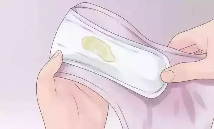 “白带多了是异常吗?”孕期与白带的二三事