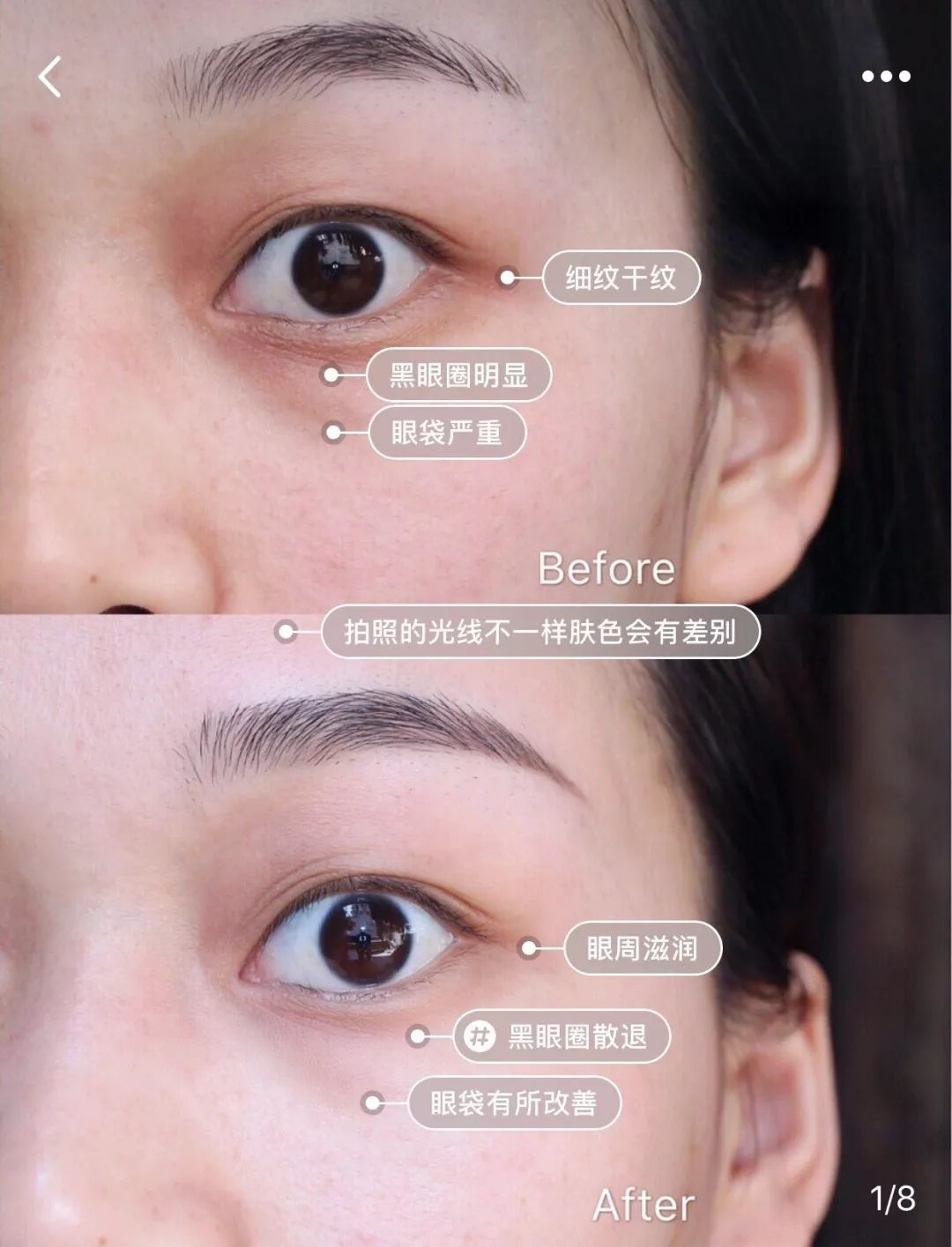 林允张韶涵面膜,林允同款眼膜推荐